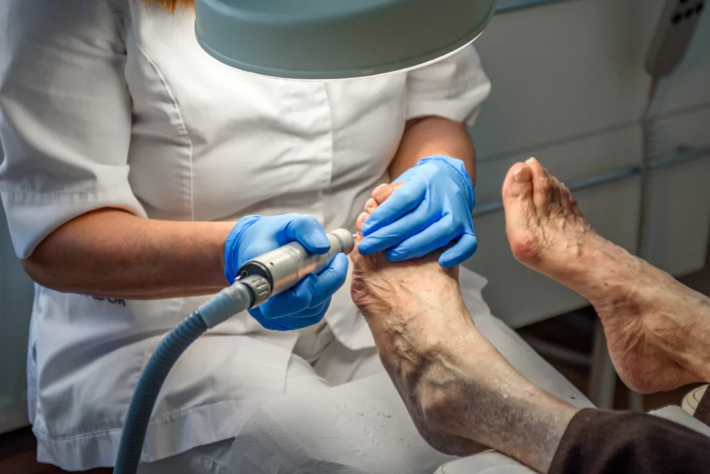close up of professional doing medical pedicure on 2026 03 23 23 50 53 utc
