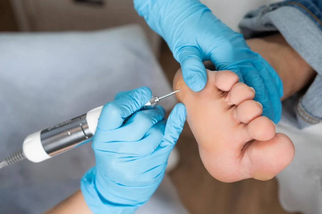 foot care with electric file and blue gloves 2026 03 23 23 27 52 utc