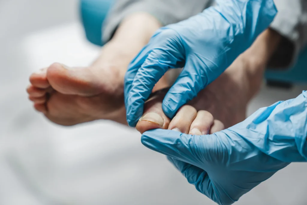 foot examination with medical gloves in clinical s 2026 03 17 08 40 15 utc