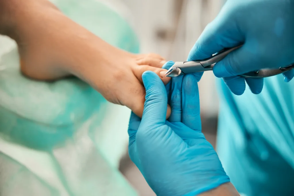 podiatrist cutting toenail with clippers in a hosp 2026 03 10 03 55 18 utc