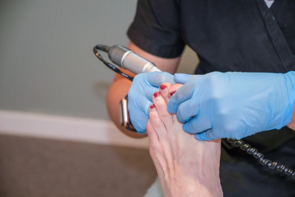 podiatrist performing foot care on adult toe nails 2026 03 24 05 09 12 utc
